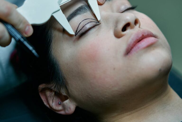 Eyelid Surgery (Blepharoplasty) Surgery