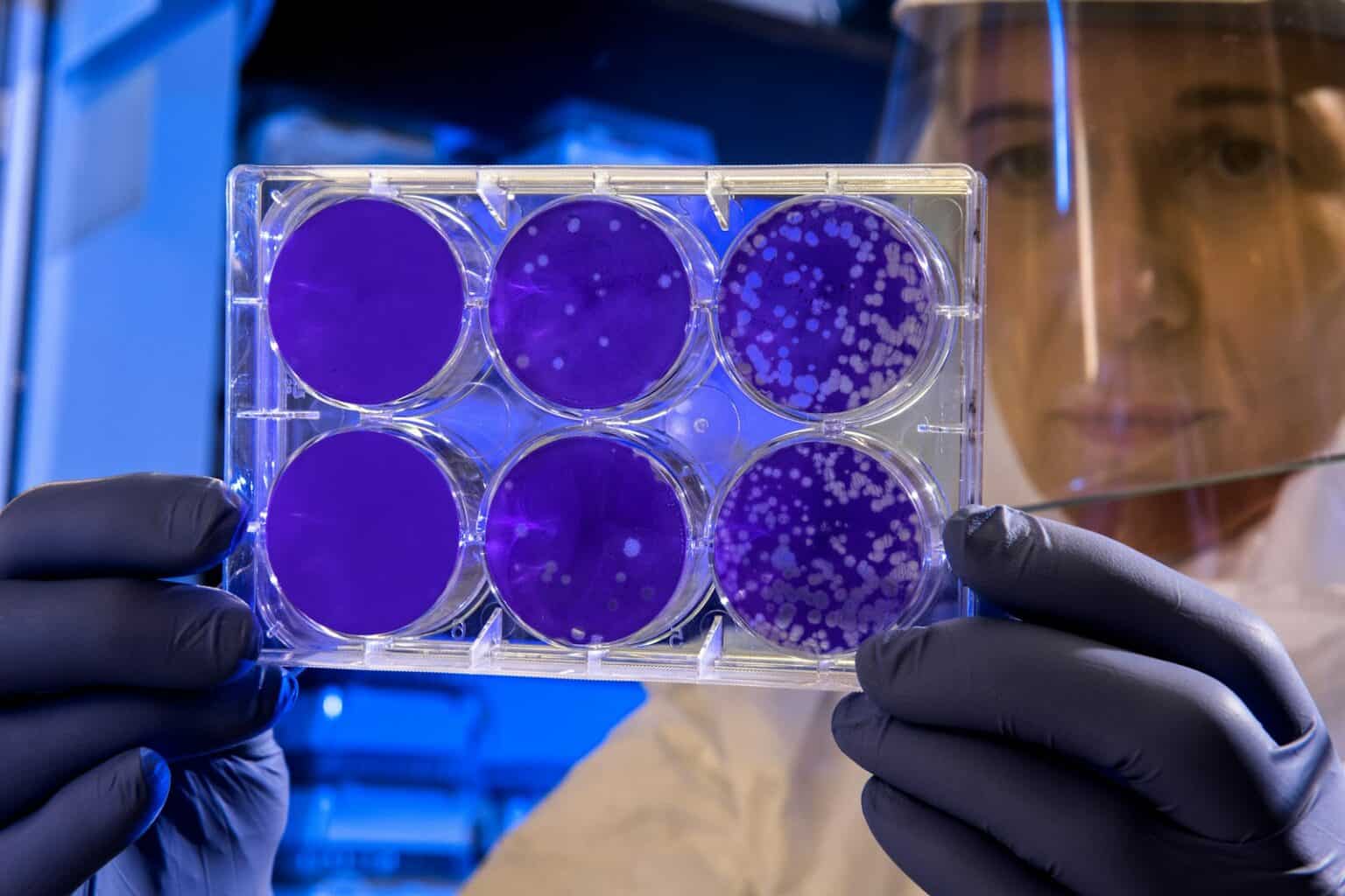 Stem Cell Therapy in Bangkok | Regenerative Medicine Thailand – Bangkok ...